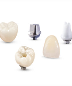 MÃO RĂNG SỨ TRÊN IMPLANT